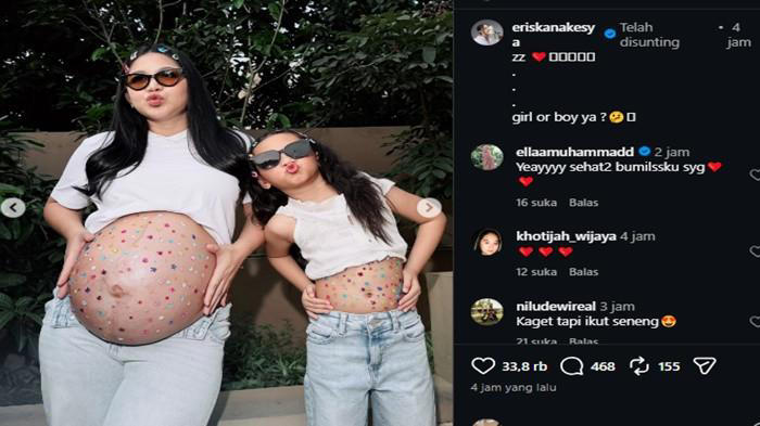 Dari Perceraian Ke Kebahagiaan Baru, Eriska Nakesya Hamil Lagi