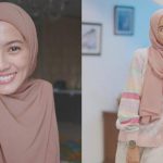 Terkejut! Alyssa Soebandono Ternyata Idap Skoliosis Sejak 2006
