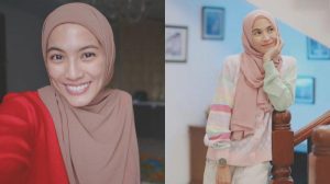 Terkejut! Alyssa Soebandono Ternyata Idap Skoliosis Sejak 2006